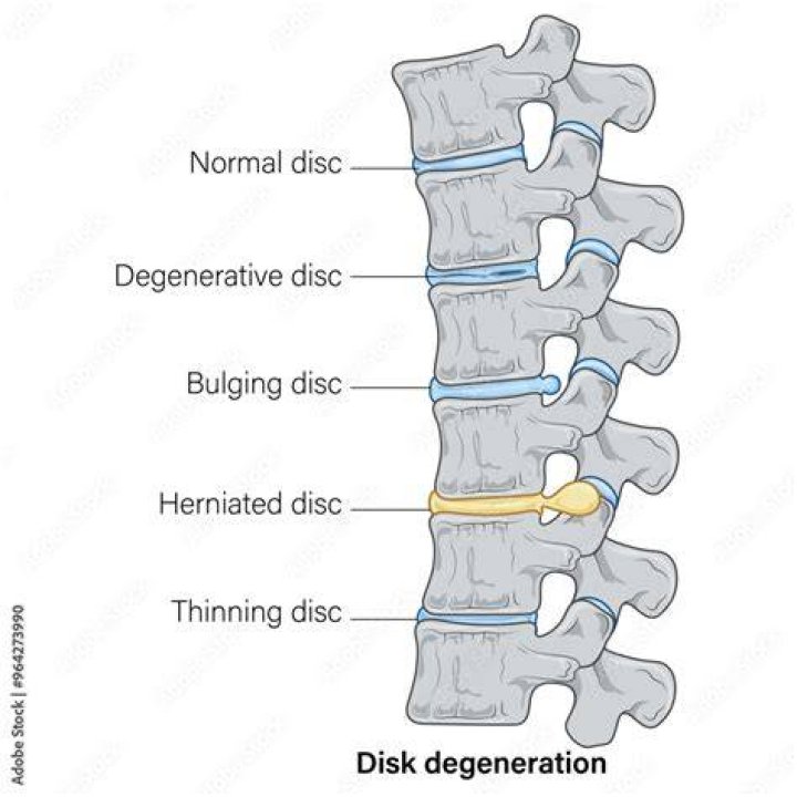 disk changes