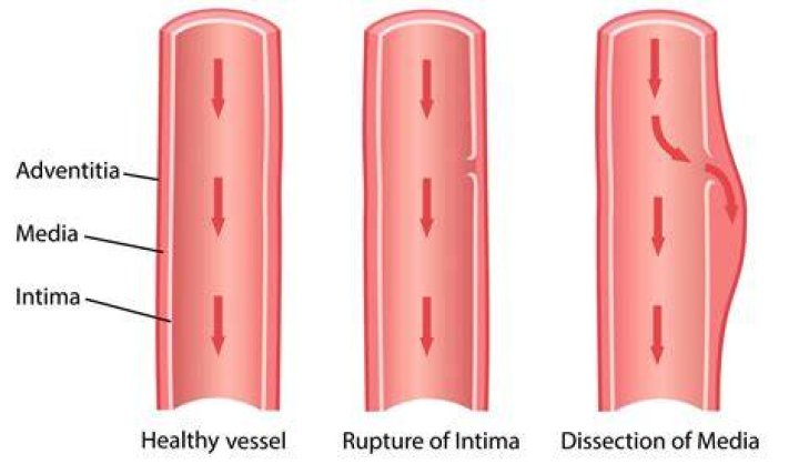 dissection