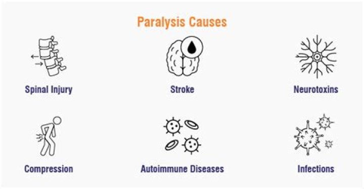 How to get the Paralysis spell?