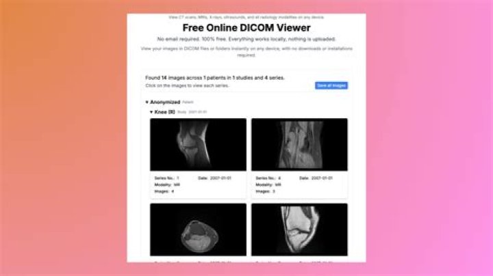 Is there a way to open DICOM files?