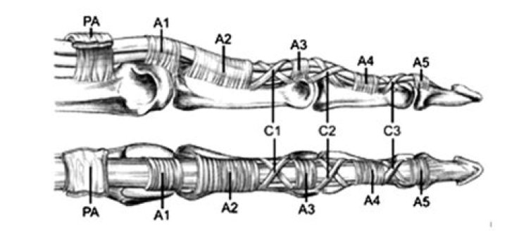 Pulley_1