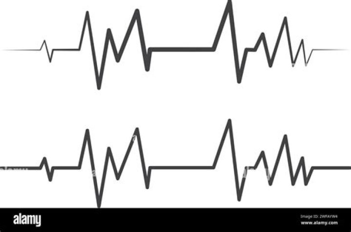 Pulse