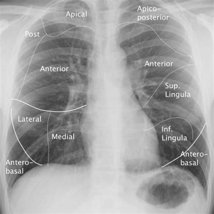 the chest can be seen at the right