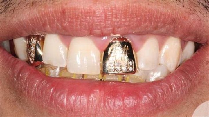What is an effective way to get all gold crowns?